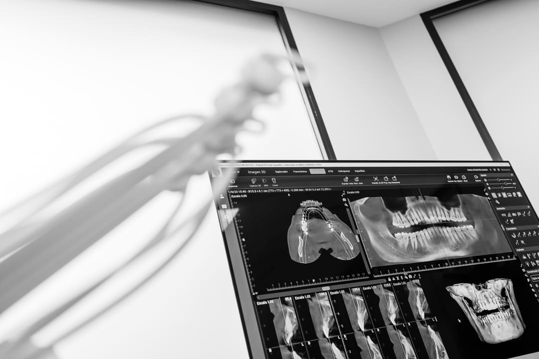 instalaciones clinica dental la roda